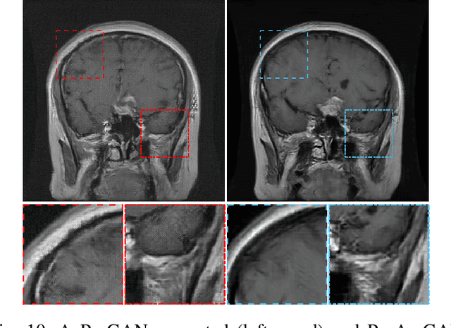 Figure 2 for Learning stochastic object models from medical imaging measurements using Progressively-Growing AmbientGANs