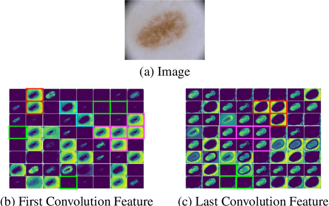 Figure 1 for GPU-Net: Lightweight U-Net with more diverse features