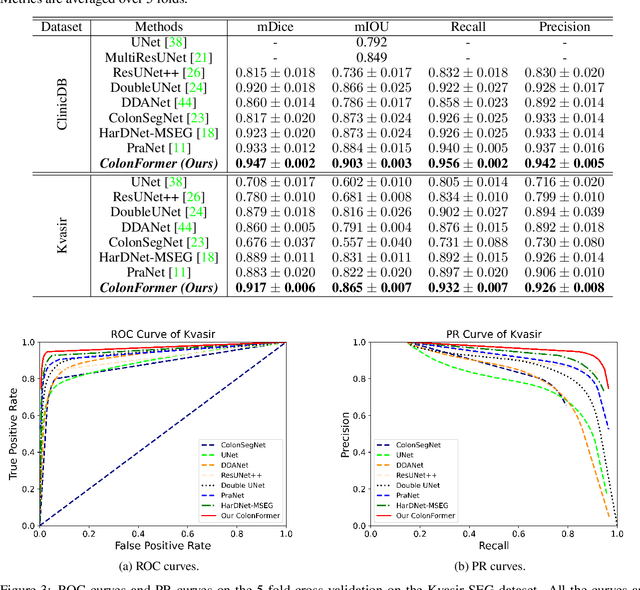 Figure 4 for ColonFormer: An Efficient Transformer based Method for Colon Polyp Segmentation