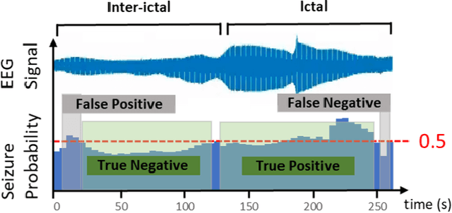 Figure 3 for Analog Seizure Detection for Implanted Responsive Neurostimulation