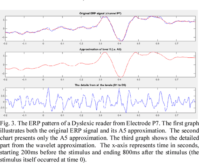 Figure 3 for Features and Machine Learning for Correlating and Classifying between Brain Areas and Dyslexia