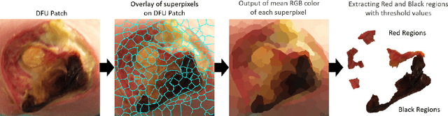 Figure 4 for Recognition of Ischaemia and Infection in Diabetic Foot Ulcers: Dataset and Techniques