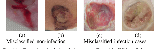 Figure 3 for Recognition of Ischaemia and Infection in Diabetic Foot Ulcers: Dataset and Techniques