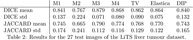 Figure 4 for Using Deep Image Prior to Assist Variational Selective Segmentation Deep Learning Algorithms