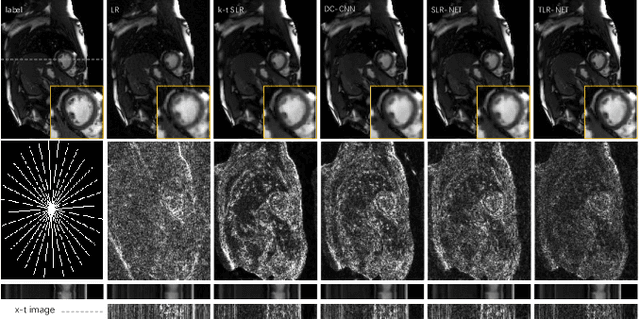 Figure 3 for Dynamic MRI using Learned Transform-based Deep Tensor Low-Rank Network (DTLR-Net)