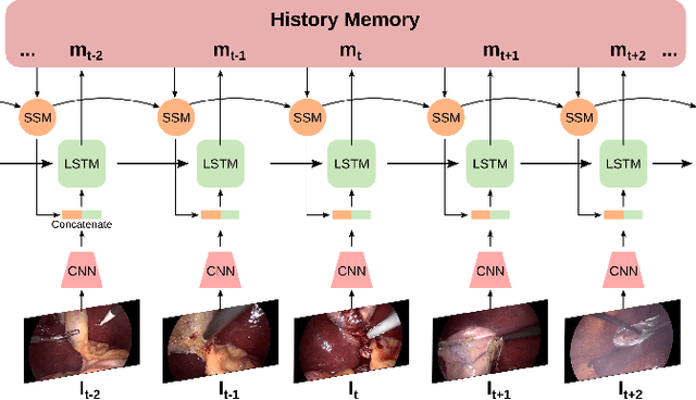 Figure 1 for Aggregating Long-Term Context for Learning Surgical Workflows