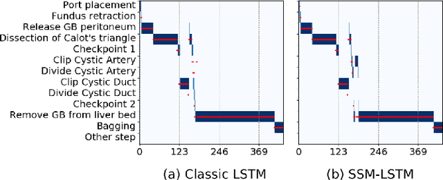 Figure 3 for Aggregating Long-Term Context for Learning Surgical Workflows
