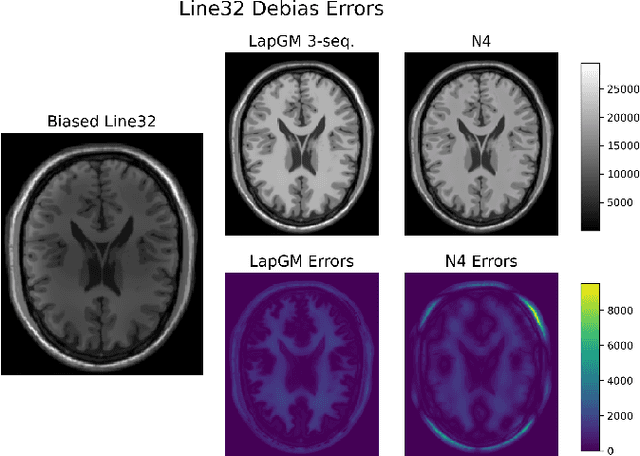 Figure 2 for LapGM: A Multisequence MR Bias Correction and Normalization Model