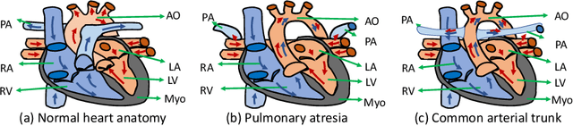Figure 1 for ImageCHD: A 3D Computed Tomography Image Dataset for Classification of Congenital Heart Disease