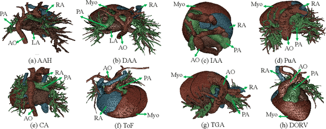 Figure 2 for ImageCHD: A 3D Computed Tomography Image Dataset for Classification of Congenital Heart Disease