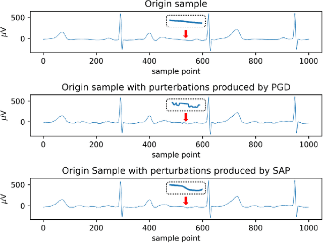 Figure 1 for Defending Against Adversarial Attack in ECG Classification with Adversarial Distillation Training