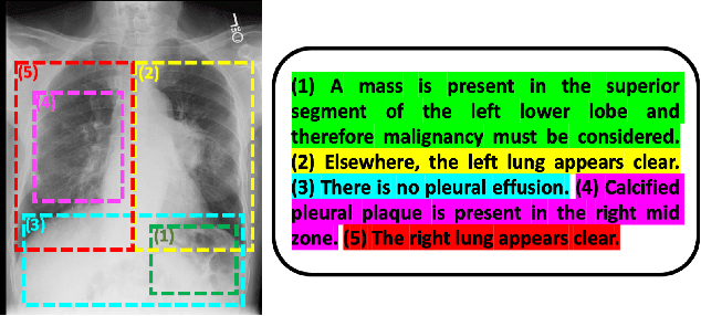 Figure 1 for Multimodal Representation Learning via Maximization of Local Mutual Information