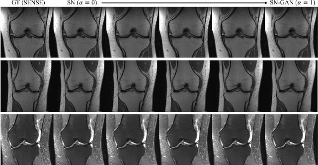 Figure 1 for Deep Network Interpolation for Accelerated Parallel MR Image Reconstruction