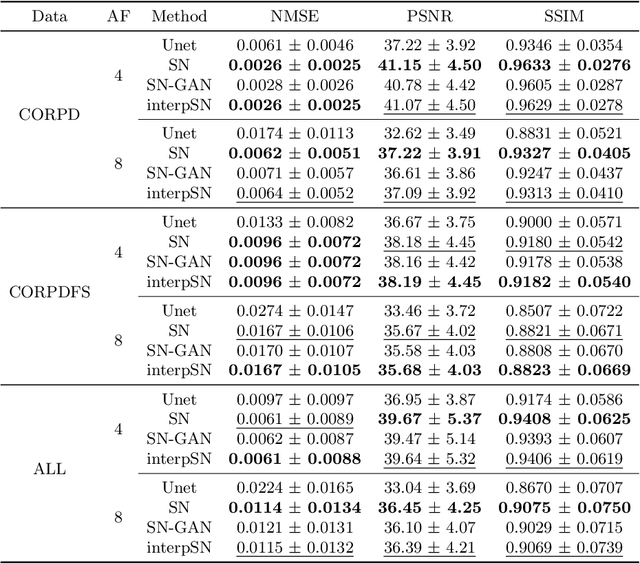 Figure 2 for Deep Network Interpolation for Accelerated Parallel MR Image Reconstruction