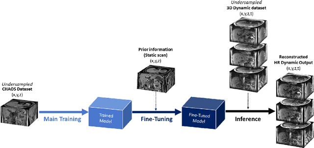 Figure 2 for Fine-tuning deep learning model parameters for improved super-resolution of dynamic MRI with prior-knowledge
