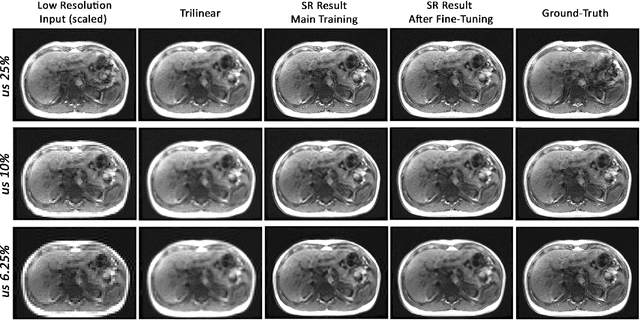 Figure 3 for Fine-tuning deep learning model parameters for improved super-resolution of dynamic MRI with prior-knowledge