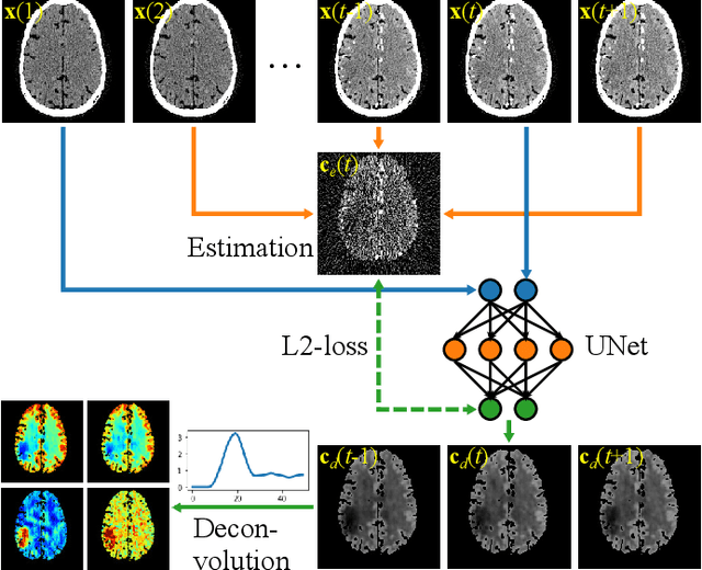 Figure 1 for Self-supervised Dynamic CT Perfusion Image Denoising with Deep Neural Networks