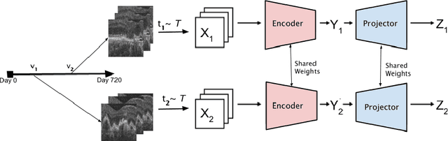 Figure 1 for TINC: Temporally Informed Non-Contrastive Learning for Disease Progression Modeling in Retinal OCT Volumes