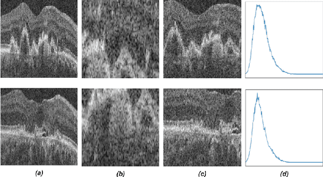 Figure 3 for TINC: Temporally Informed Non-Contrastive Learning for Disease Progression Modeling in Retinal OCT Volumes