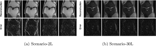 Figure 4 for Active MR k-space Sampling with Reinforcement Learning