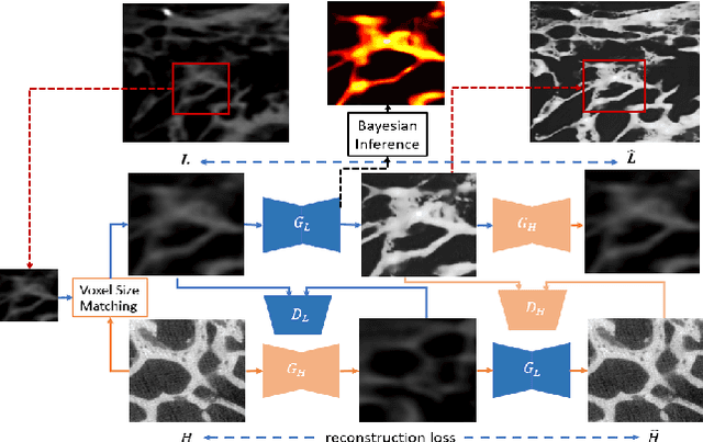 Figure 1 for Micro-CT Synthesis and Inner Ear Super Resolution via Bayesian Generative Adversarial Networks