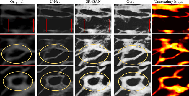 Figure 2 for Micro-CT Synthesis and Inner Ear Super Resolution via Bayesian Generative Adversarial Networks