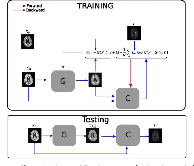 Figure 1 for Simultaneous synthesis of FLAIR and segmentation of white matter hypointensities from T1 MRIs