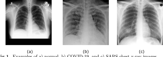 Figure 1 for Classification of COVID-19 in chest X-ray images using DeTraC deep convolutional neural network