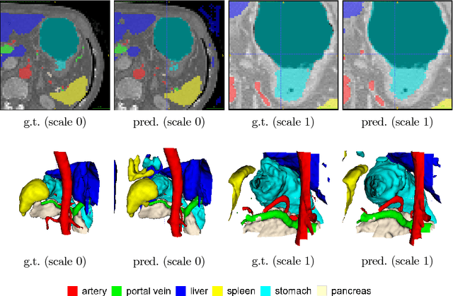 Figure 3 for A multi-scale pyramid of 3D fully convolutional networks for abdominal multi-organ segmentation