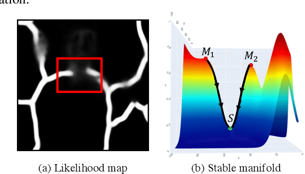 Figure 4 for Learning Probabilistic Structural Representation for Biomedical Image Segmentation