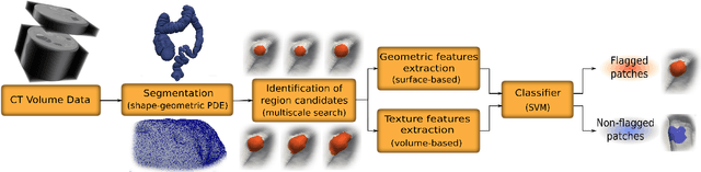 Figure 1 for A Complete System for Candidate Polyps Detection in Virtual Colonoscopy