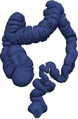 Figure 4 for A Complete System for Candidate Polyps Detection in Virtual Colonoscopy