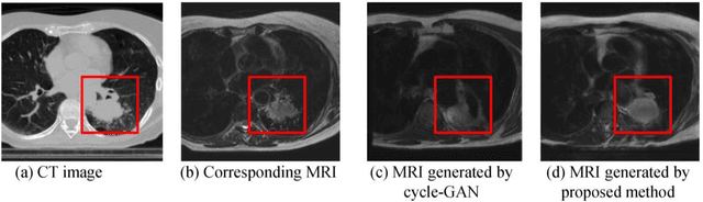 Figure 1 for Cross-modality (CT-MRI) prior augmented deep learning for robust lung tumor segmentation from small MR datasets
