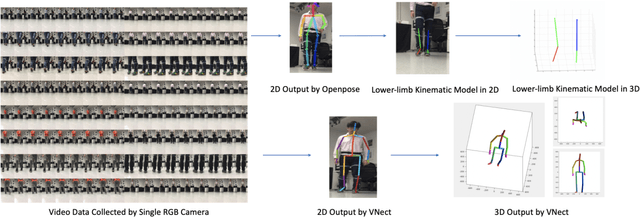 Figure 1 for A Single RGB Camera Based Gait Analysis with a Mobile Tele-Robot for Healthcare