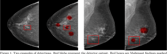 Figure 1 for A Hypersensitive Breast Cancer Detector