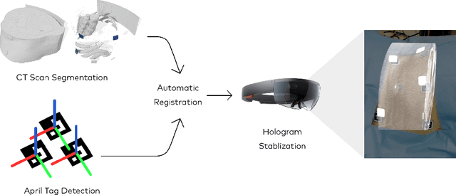 Figure 1 for Image-based marker tracking and registration for intraoperative 3D image-guided interventions using augmented reality