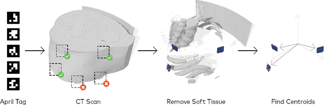 Figure 2 for Image-based marker tracking and registration for intraoperative 3D image-guided interventions using augmented reality