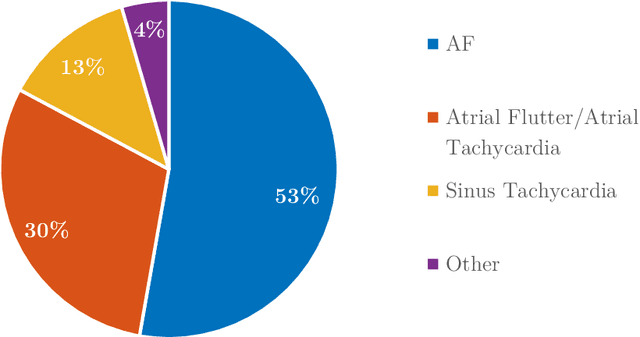 Figure 1 for Improved Cardiac Arrhythmia Prediction Based on Heart Rate Variability Analysis