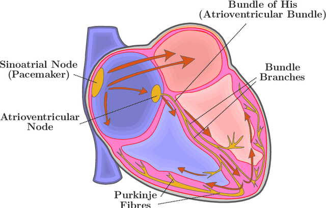 Figure 4 for Improved Cardiac Arrhythmia Prediction Based on Heart Rate Variability Analysis