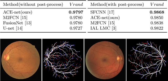 Figure 4 for ACE-Net: Biomedical Image Segmentation with Augmented Contracting and Expansive Paths