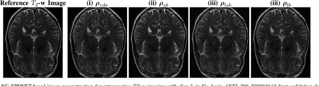 Figure 3 for Learning the sampling density in 2D SPARKLING MRI acquisition for optimized image reconstruction