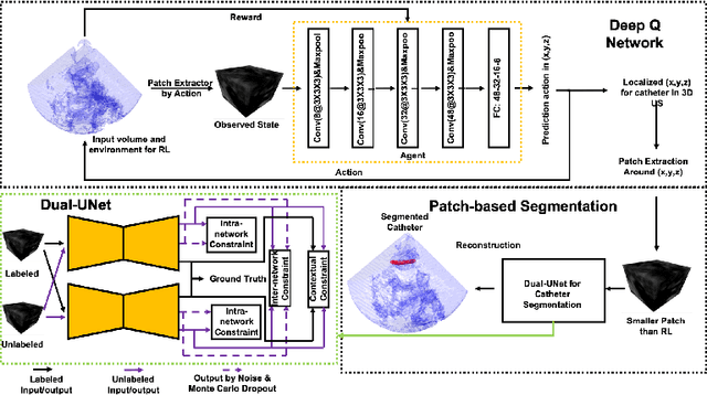Figure 1 for Deep Q-Network-Driven Catheter Segmentation in 3D US by Hybrid Constrained Semi-Supervised Learning and Dual-UNet
