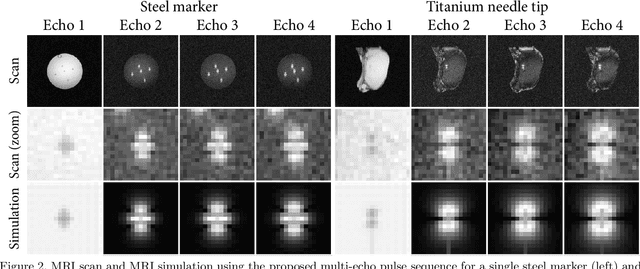 Figure 2 for SMART tracking: Simultaneous anatomical imaging and real-time passive device tracking for MR-guided interventions