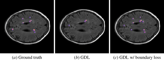 Figure 1 for Boundary loss for highly unbalanced segmentation