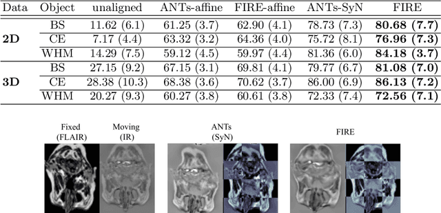 Figure 2 for FIRE: Unsupervised bi-directional inter-modality registration using deep networks