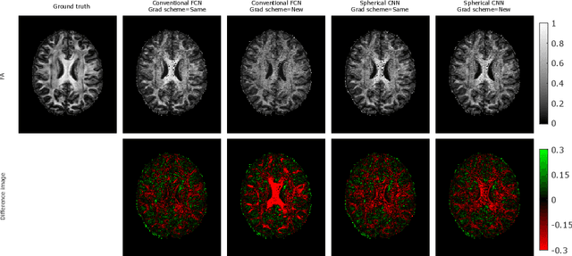 Figure 2 for How can spherical CNNs benefit ML-based diffusion MRI parameter estimation?