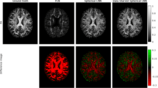 Figure 4 for How can spherical CNNs benefit ML-based diffusion MRI parameter estimation?