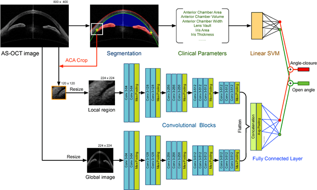 Figure 3 for Multi-Context Deep Network for Angle-Closure Glaucoma Screening in Anterior Segment OCT