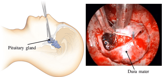 Figure 1 for Single-Shot Pose Estimation of Surgical Robot Instruments' Shafts from Monocular Endoscopic Images