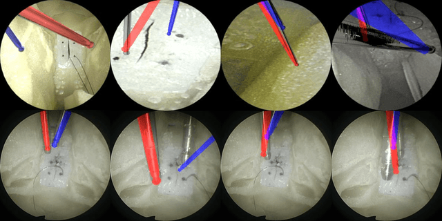 Figure 4 for Single-Shot Pose Estimation of Surgical Robot Instruments' Shafts from Monocular Endoscopic Images